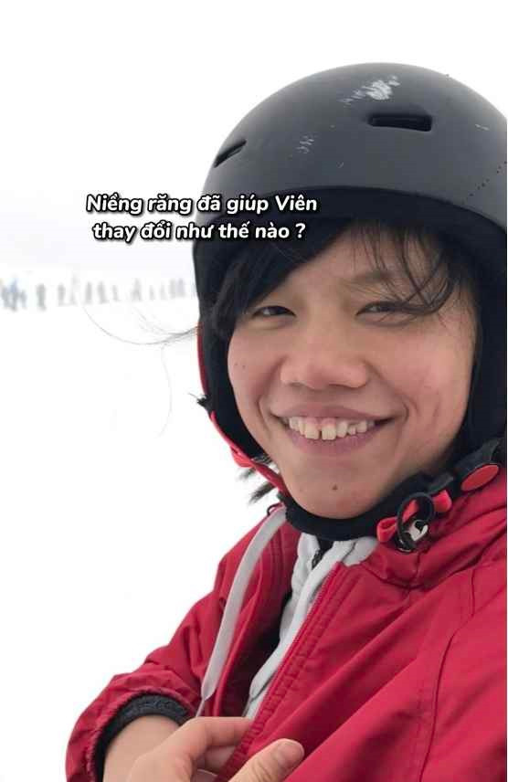 Dù thăng hạng nhan sắc hơn hẳn, Ánh Viên chưa bao giờ chối bỏ quá khứ chưa xinh của mình. Cô thường chia sẻ lại hình ảnh trong quá khứ như 1 cách để thể hiện sự biết ơn nỗ lực của chính mình trong hành trình "lột xác" để toả sáng hơn.