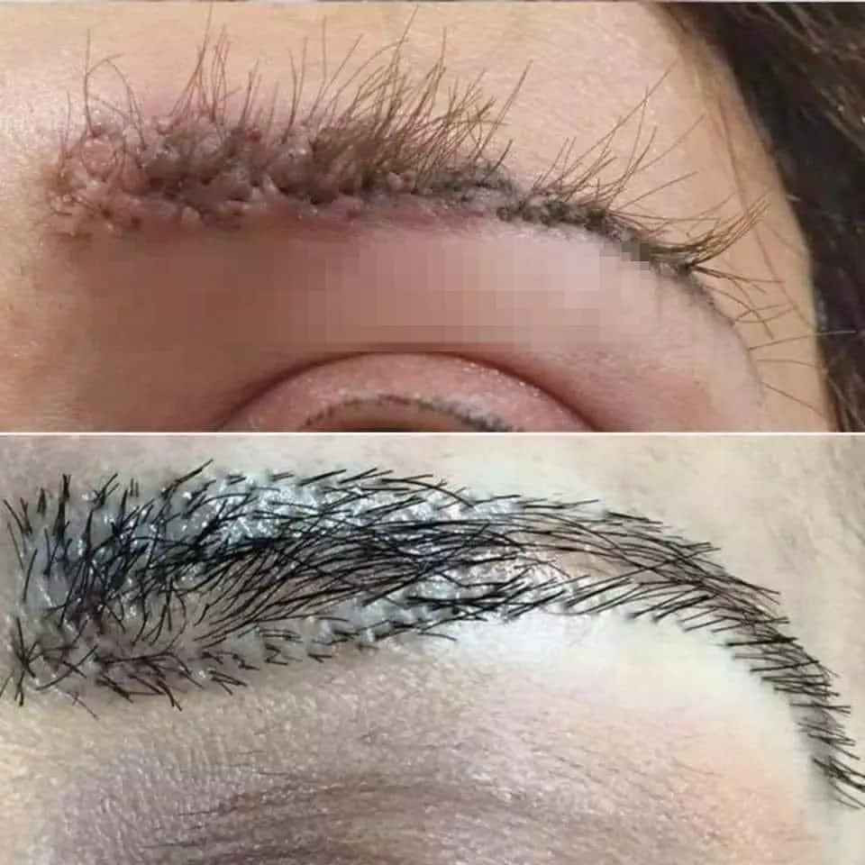 Mới đây, trên một diễn đàn rất đông thành viên đã chia sẻ hình ảnh về một người phụ nữ đi cấy lông mày.