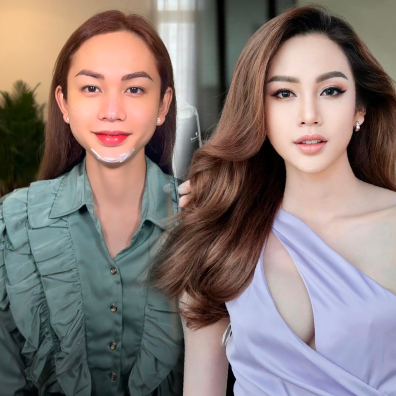 Lương Mỹ Kỳ ngày càng mảnh khảnh hậu phẫu thuật thẩm mỹ Luong My Ky ngay cang manh khanh hau phau thuat tham my