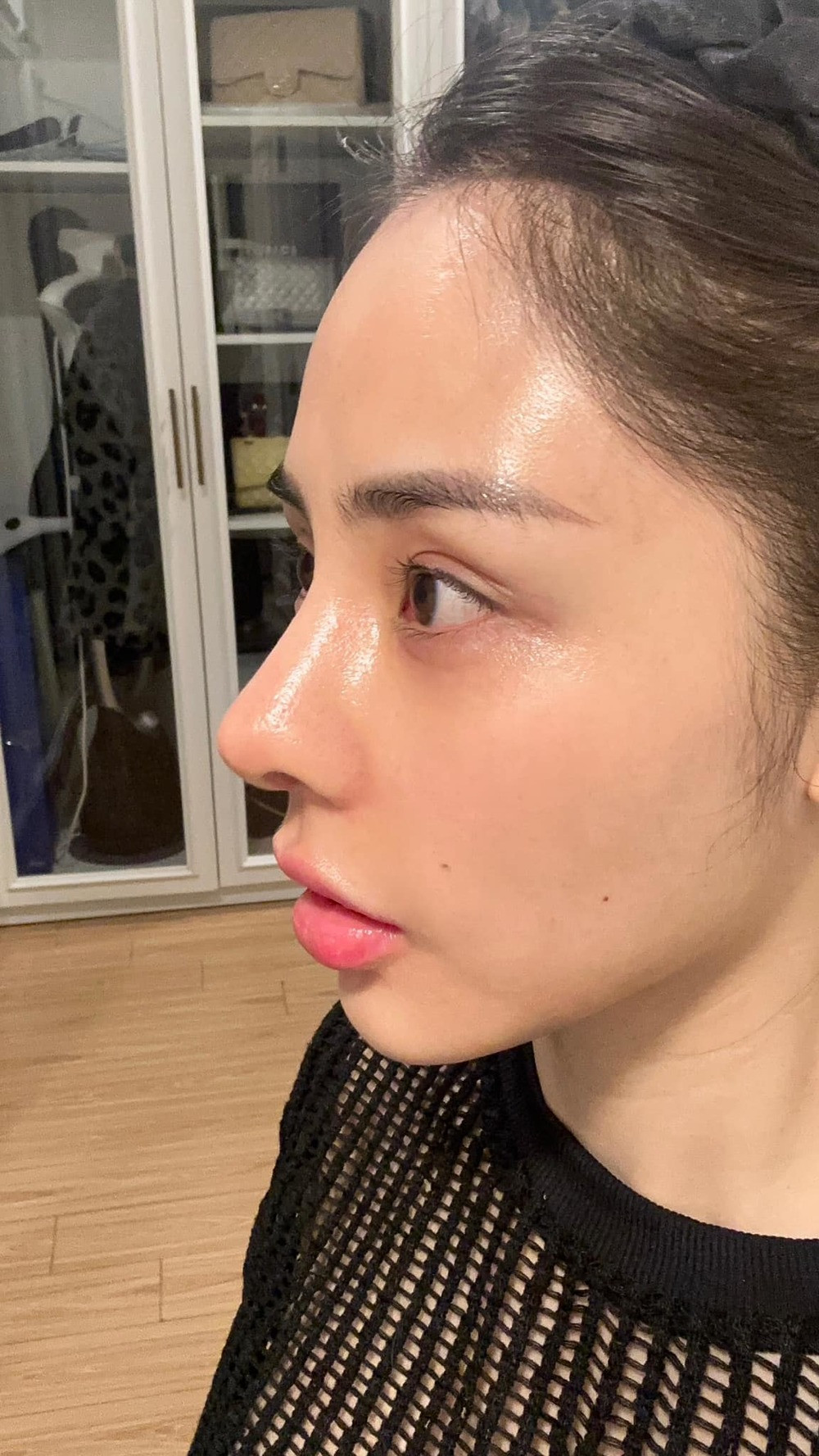 Trước đó hồi đầu năm, Bạch Lan Phương không ngần ngại công khai trên trang cá nhân về việc chỉnh sửa nhan sắc.