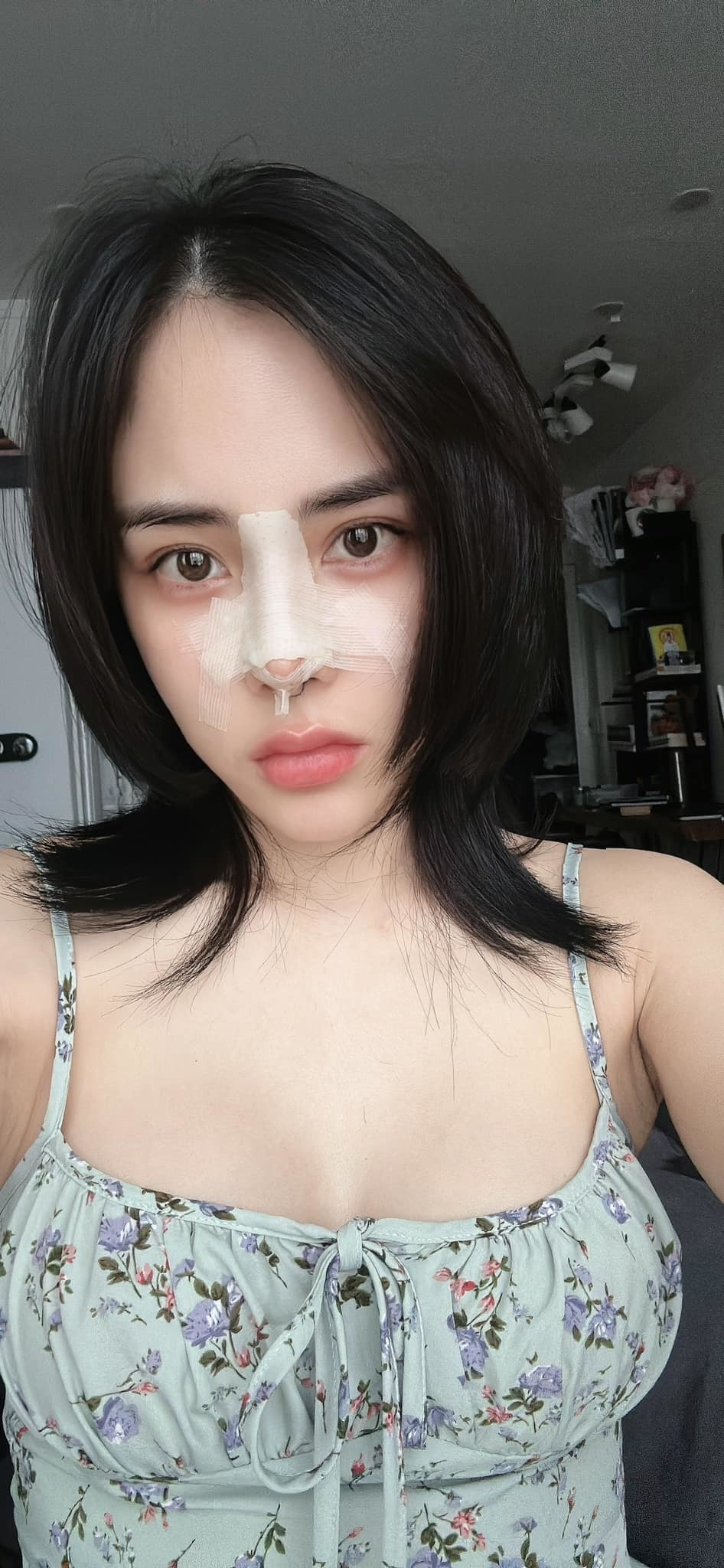 Năm 2022, Bạch Lan Phương cũng từng chi hàng trăm triệu đồng để sửa dáng mũi cho phù hợp hơn với khuôn mặt.