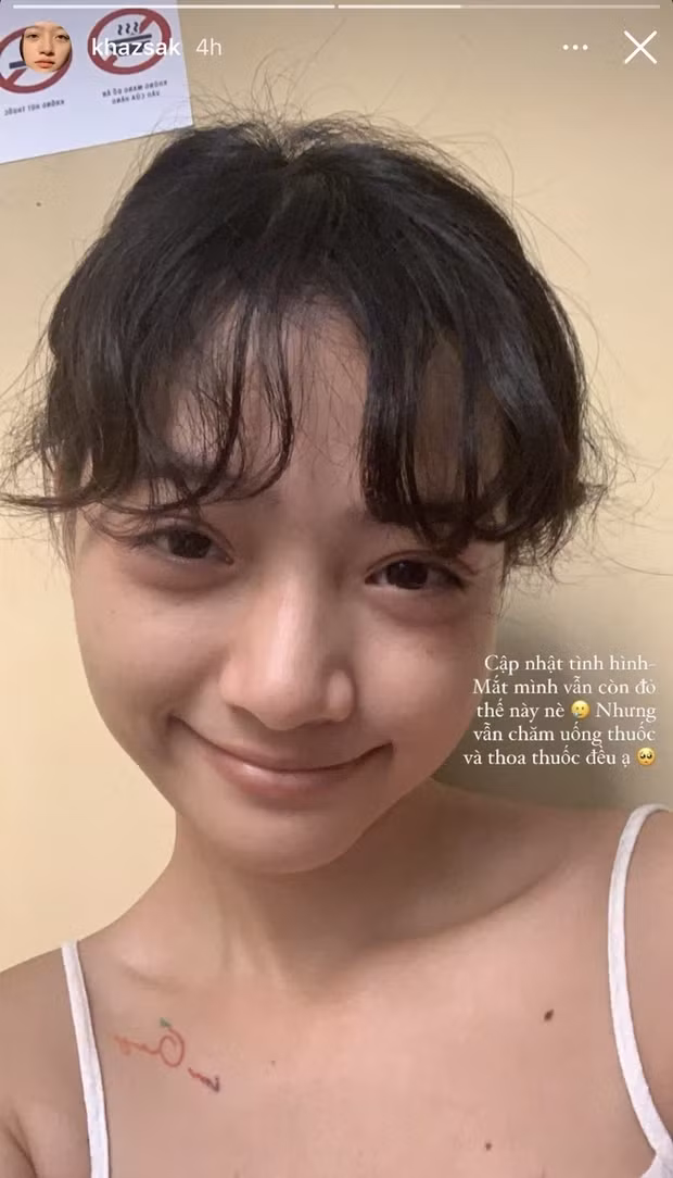 Gái xinh tóc xù siêu hot trên Instagram - Khazsak có vẻ nhợt nhạt hơn so với khi trang điểm nhưng vẫn khiến vạn người phải mê mẩn.