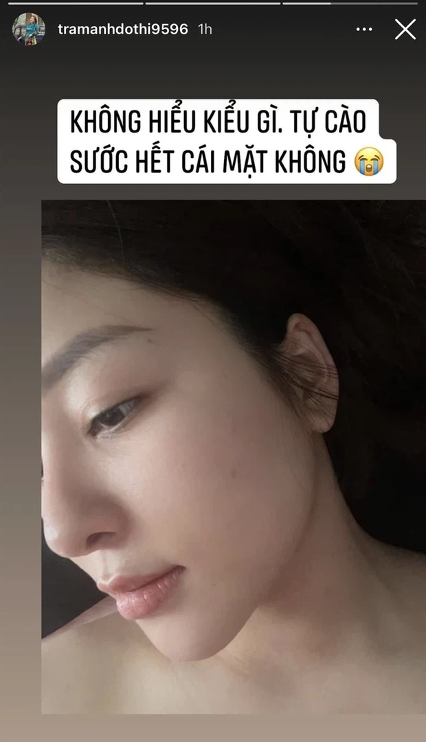 Rõ là đang than thở nhưng Trâm Anh lại khoe khéo được nhan sắc không trang điểm đỉnh cao, đường nét nào cũng nét căng