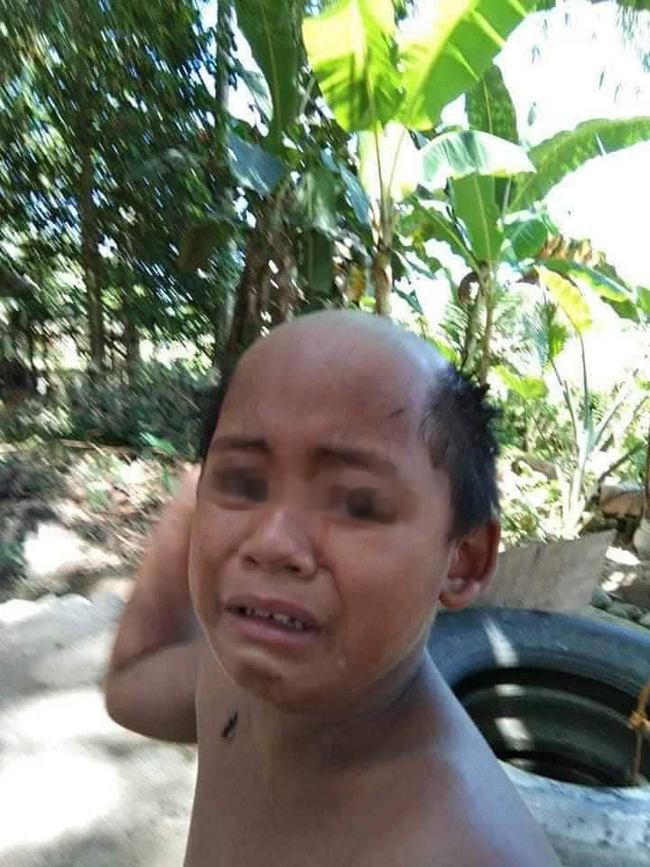 Cụ thể, mái tóc dài rậm của cậu con trai đã bị bố đi tông đơ thẳng một đường từ gáy lên đến tận... trán khiến cậu bé chẳng khác nào... ông cụ non U50 với cái đầu hói toàn phần giữa, chỉ lộ tóc ở 2 bên.