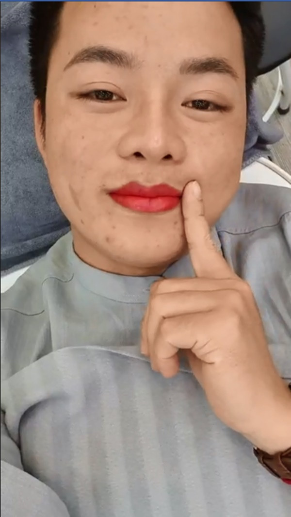 Bên cạnh những lời bình luận tích cực, hình ảnh mới của chồng cô dâu Thu Sao cũng vấp phải không ít gạch đá bởi bờ môi gây sự chú ý cực mạnh.