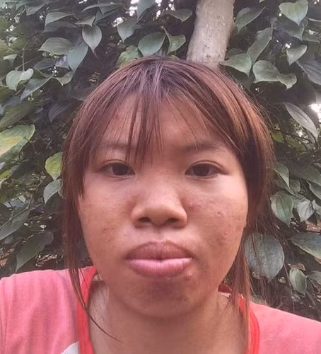 Còn nhớ vào khoảng năm 2016, Phượng “Thị Nở” (tên thật là Quách Thị Kim Phượng, sinh năm 1995, quê Đắk Nông) nổi tiếng khắp MXH vì câu chuyện “đập mặt xây lại” của mình.