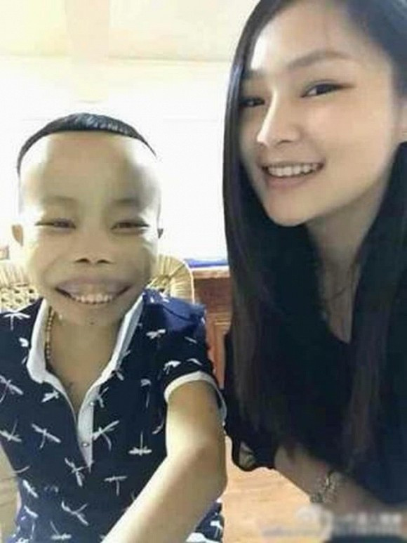 Thực tế, Trần Sơn có một tuổi thơ rất nghèo khó. Sinh ra đã bị mắc một căn bệnh có tên thalassemia (tan máu bẩm sinh) khiến anh chàng có ngoại hình có phần xấu xí, khác người.