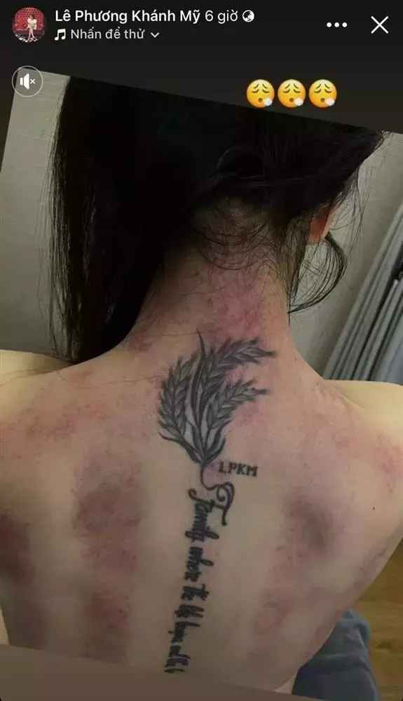 Ở story thứ nhất, đính kèm ảnh thương tích đầy mình Vân Navy tiết lộ bị "chồng đánh".