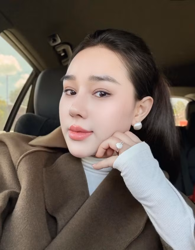 Gương mặt của vợ Tấn Tài sau nhiều lần can thiệp thẩm mỹ cũng không còn sự sắc nét, hài hoà. So với ảnh Phạm Hiếu tự đăng trên mạng, ảnh ngoài đời khác xa.