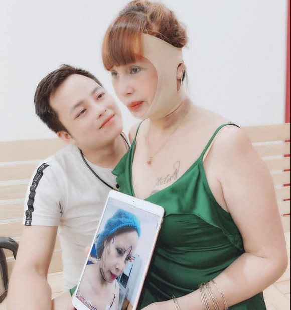 Thu Sao cũng tiết lộ về những nguy cơ rủi ro đến sức khỏe khi tiến hành thẩm mỹ quá nhiều khi tuổi đã cao.