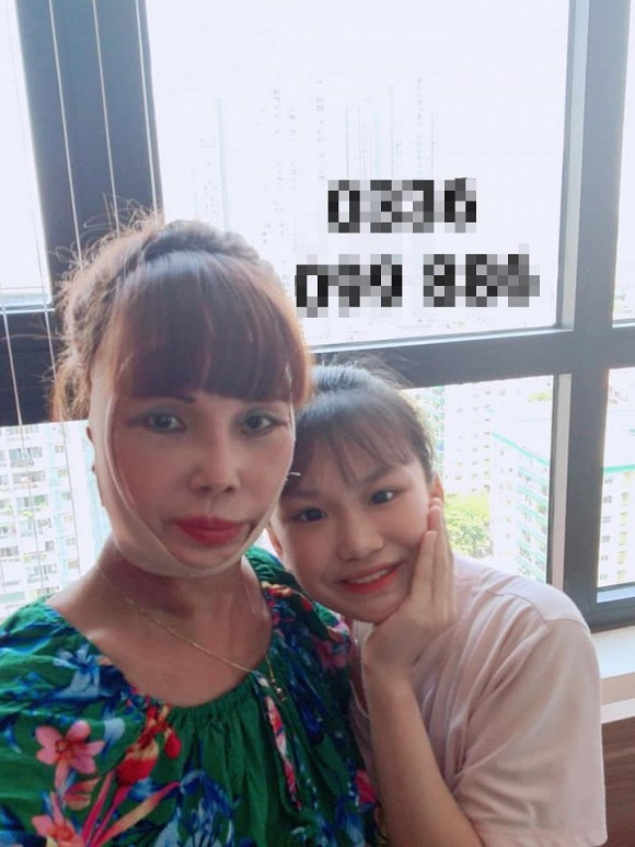 Hiện tại, gương mặt của chị Thu Sao đã bớt sưng nhưng cặp đôi lệch tuổi vẫn quyết định ở tại Hà Nội đến khi tháo chỉ, vết thương lành mới trở về Cao Bằng.