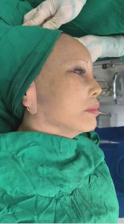 Không thể phủ nhận rằng sau khi trùng tu, nhan sắc của chị Thu Sao trông trẻ hơn tuổi thực rất nhiều. Nhưng cũng có ý kiến khuyên, cô dâu 62 tuổi Cao Bằng không nên lạm dụng "dao kéo" vì nguy hiểm và ảnh hưởng đến sức khỏe, nhất là khi tuổi của chị không còn trẻ.