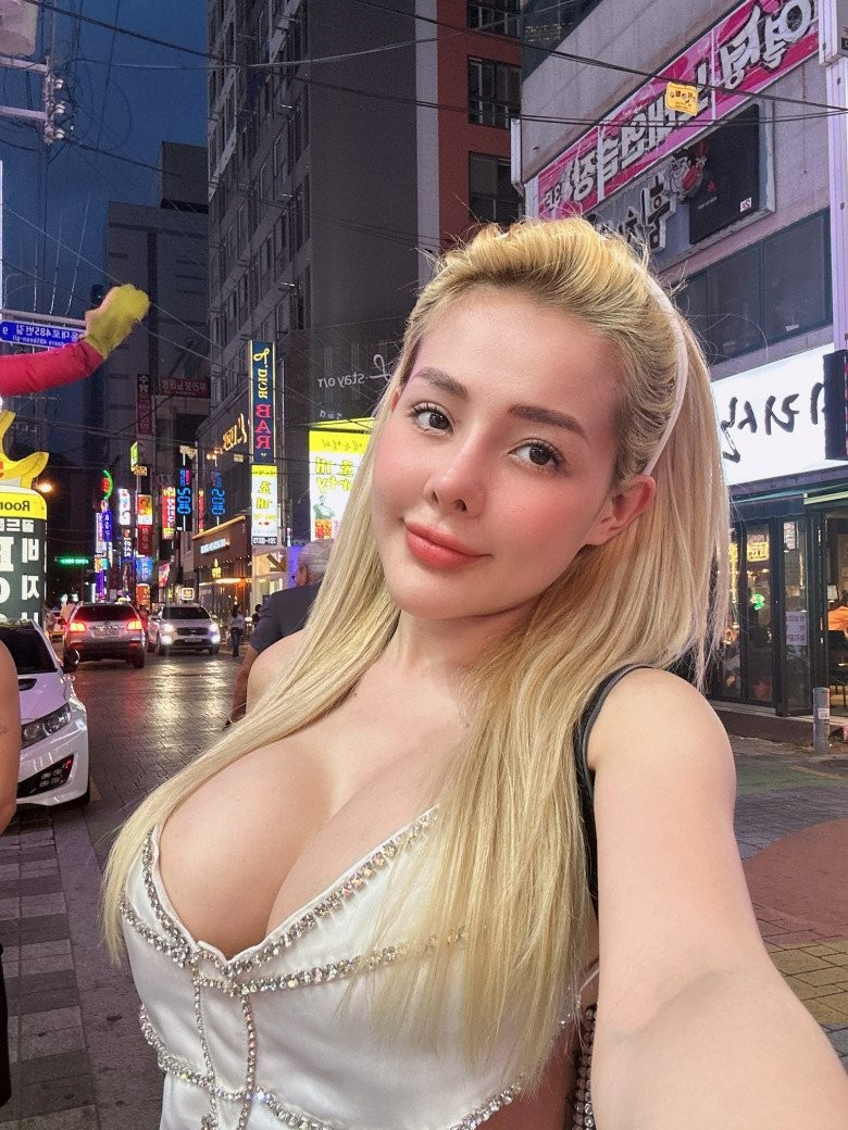 Sau khoảng 2 tuần thẩm mỹ, Ngân 98 đã hồi phục hoàn toàn. Kết quả được Ngân 98 chia sẻ như sau: "Về phần mắt, tôi rất ưng ý nhưng mũi thì chưa được như mong muốn. Sắp tới tôi sẽ chỉnh lại một chút để hợp với mặt hơn."