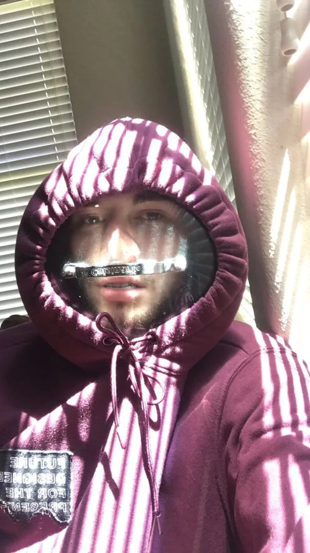 Ngay sau khi xuất hiện, loại khẩu trang được làm bằng vung nồi đã được nhiều bạn trẻ đã áp dụng và biến vật dụng trong nhà bếp này trở thành chiếc khẩu trang hữu hiệu.