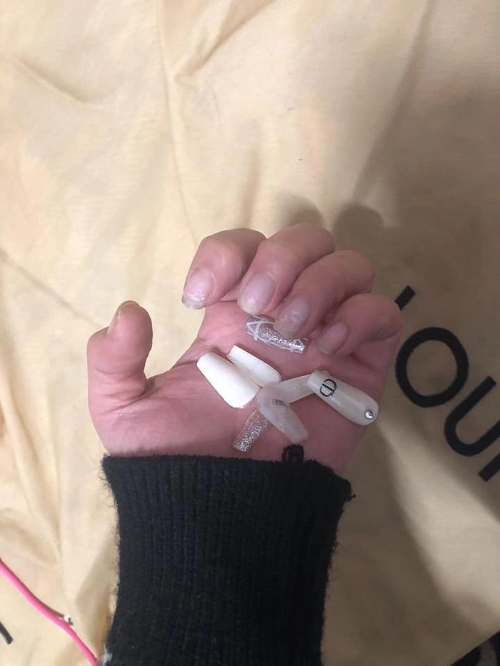 Dưới phần bình luận, nhiều chị em cũng cập nhập tình trạng bộ nail của mình. Có nhiều người còn không dấu khỏi nỗi xót xa khi nhìn bộ móng trở nên tàn tạ.