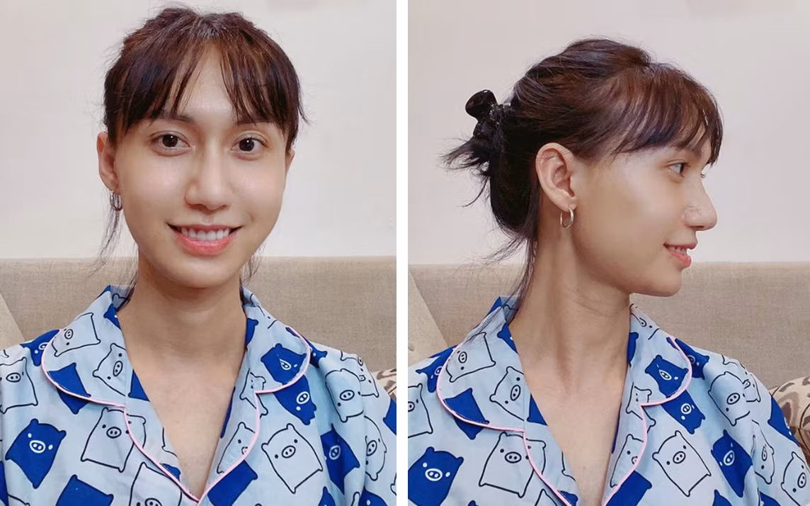 Lynk Lee cũng thường xuyên khoe nhan sắc nữ tính của mình trên trang cá nhân sau khi công bố giới tính thật.