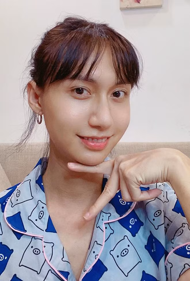 Sau khi nuôi tóc dài và chỉnh sửa đôi chút trên gương mặt, Lynk Lee nhận không ít lời khen về vẻ đẹp nữ tính.