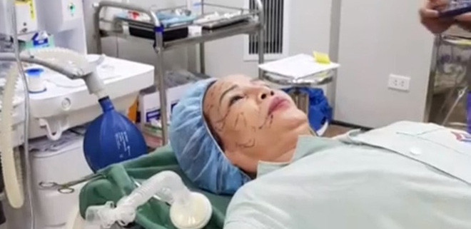 Nhiều người bày tỏ lo lắng khi chị Thu Sao liều lĩnh thực hiện các cuộc phẫu thuật thẩm mỹ lớn nhỏ dù đã ngoài tuổi 60.