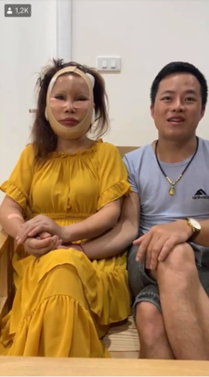 Trước đó, cô dâu Thu Sao từng chi hơn 100 triệu đồng trăm để làm răng, cấy mỡ mặt, 50 triệu đồng để nâng mũi, kéo cung mày.