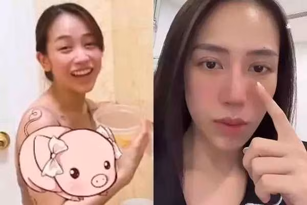 Dễ dàng nhận thấy chiếc mũi bà mẹ trẻ thanh thoát hơn trước rất nhiều.