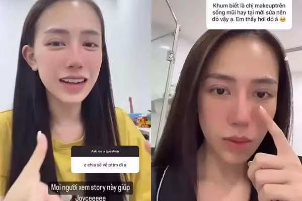 Trong một chia sẻ với mọi người, Joyce Phạm cho biết đã làm mũi.