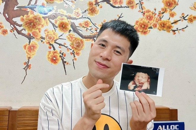 Trong khoảnh khắc khác, ông bố trẻ già trông thấy khi để râu dài, mặt mệt mỏi vì phải thức đêm nhiều.