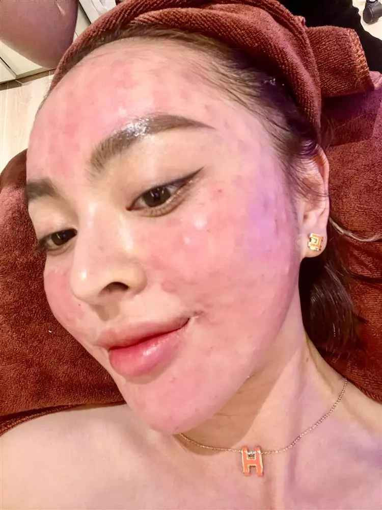 Chia sẻ trên Tiktok, Trang Nemo cũng từng gây chú ý khi tiết lộ đã trải qua nhiều lần thẩm mỹ mới có được nhan sắc nổi bật.