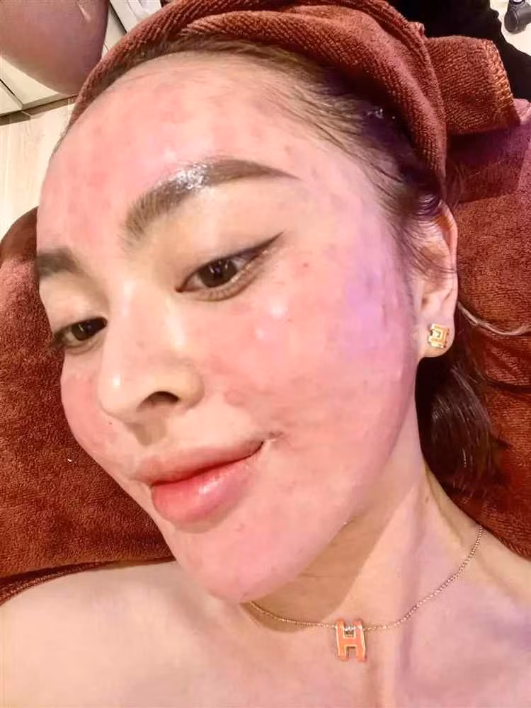 Chia sẻ trên Tiktok, Trang Nemo cũng từng gây chú ý khi tiết lộ đã trải qua nhiều lần thẩm mỹ mới có được nhan sắc nổi bật.