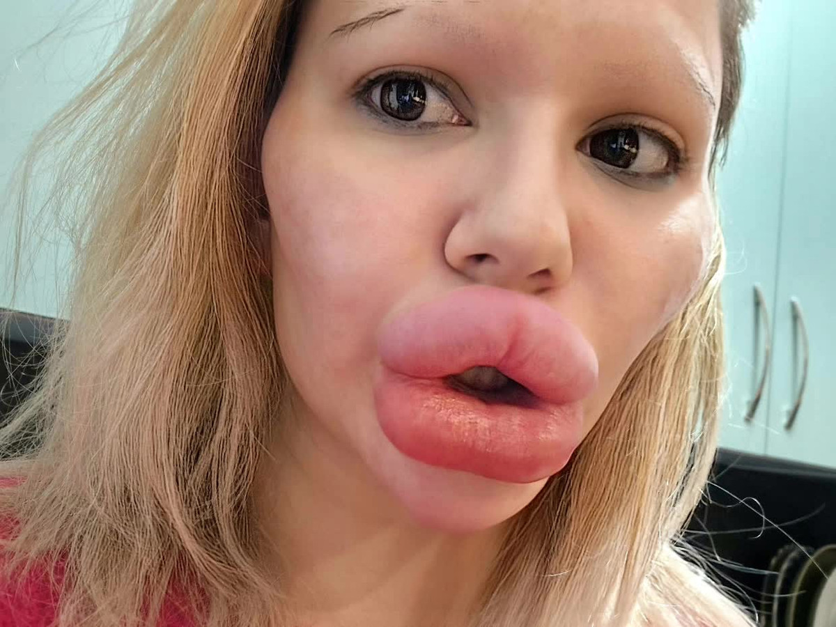 Tưởng chừng như cô gái này sẽ sở hữu ngoại hình ngày càng xinh đẹp thì những hình ảnh về diện mạo của Andrea lại khiến nhiều người sợ hãi.