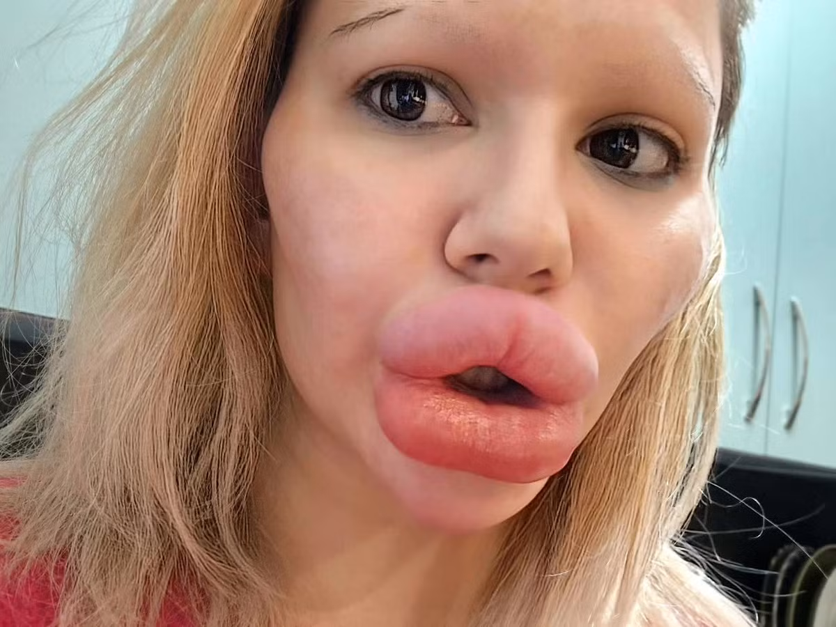 Tưởng chừng như cô gái này sẽ sở hữu ngoại hình ngày càng xinh đẹp thì những hình ảnh về diện mạo của Andrea lại khiến nhiều người sợ hãi.