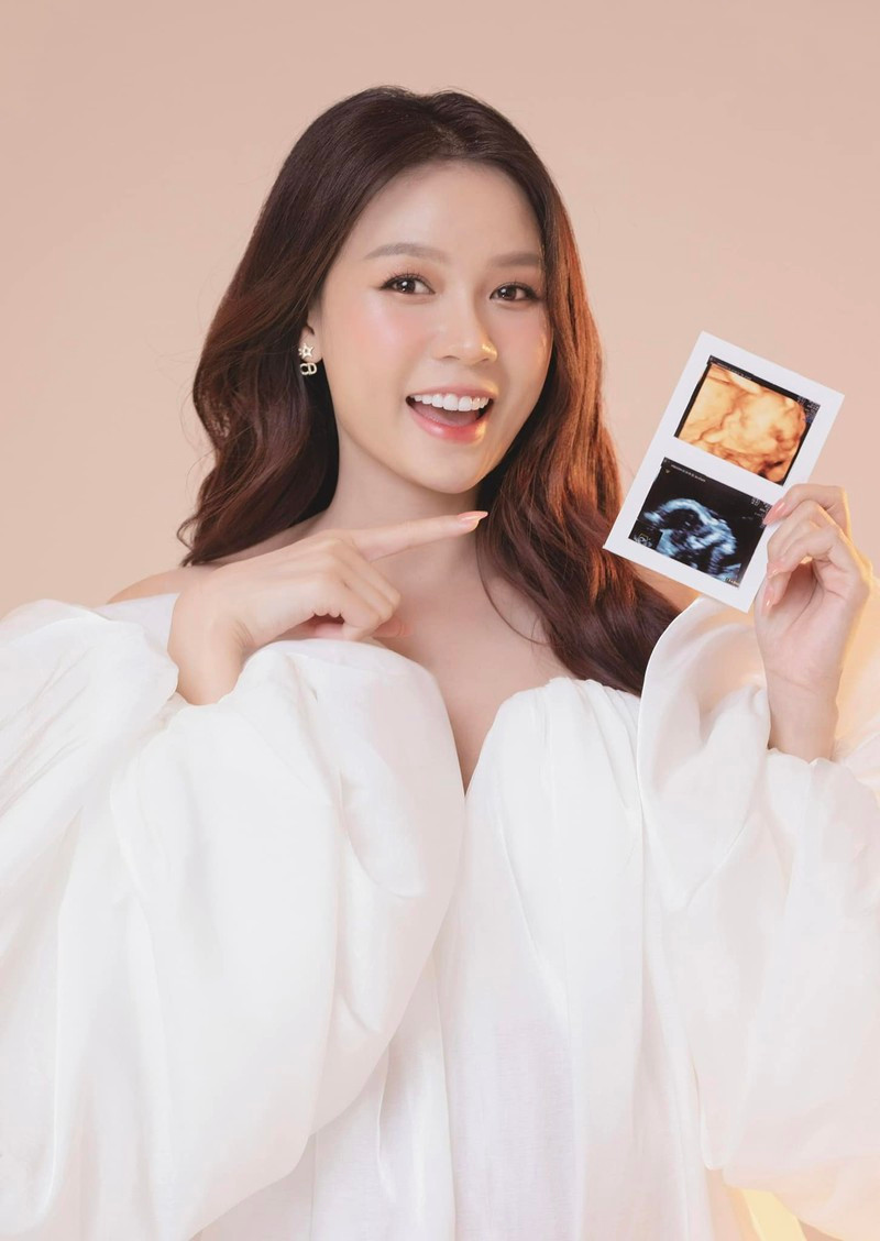 “Lần đầu trong cuộc đời tôi bị nổi nhiều mụn đến như vậy. Tôi nghén nặng nên trong mấy tháng đầu không đi đâu, chỉ ru rú ở trong nhà” – Sam cho hay.