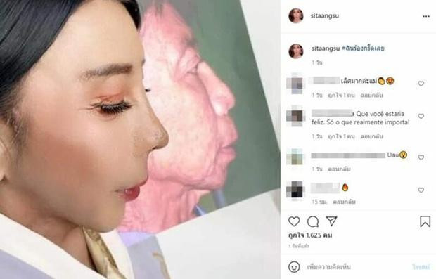 Nhiều người bày tỏ bất ngờ khi xem loạt ảnh mới nhất của Sitang Buathong. Họ cho rằng phẫu thuật thẩm mỹ chính là thứ đã tái sinh gương mặt của người phụ nữ này.