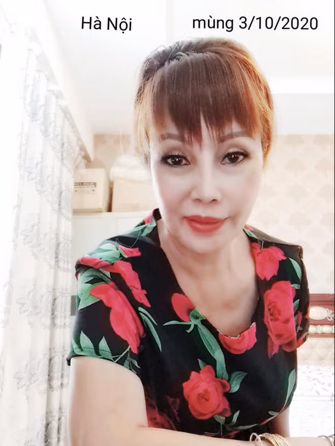 Cụ thể, trong loạt hình "tự sướng" vào ngày 3/10 tại Hà Nội, dù cô Thu Sao đã chụp hình thông qua phần mềm làm đẹp, song vẫn để lộ gương mặt có nhiều bất thường so với hình ảnh trước kia: miệng méo hẳn về phía bên phải; hai má xập xệ không cân xứng, chiếc mũi cũng có phần lệch, đôi mắt thâm quầng...