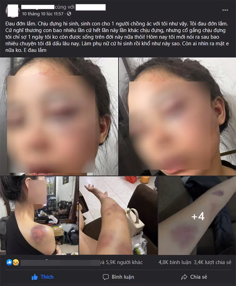 Co vo 9X to chong bao hanh bam dap, netizen nhin ma xot xa