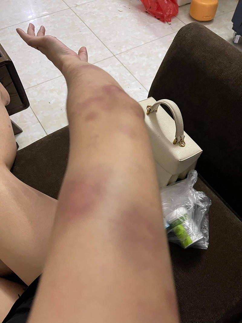 Co vo 9X to chong bao hanh bam dap, netizen nhin ma xot xa-Hinh-4