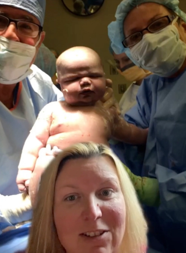 Be so sinh chao doi da nang 6,5 kg, gap 3 tre binh thuong