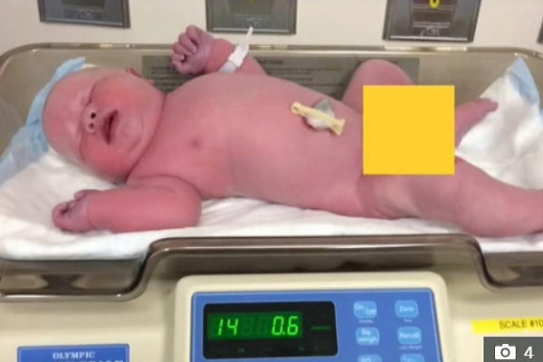 Be so sinh chao doi da nang 6,5 kg, gap 3 tre binh thuong-Hinh-2