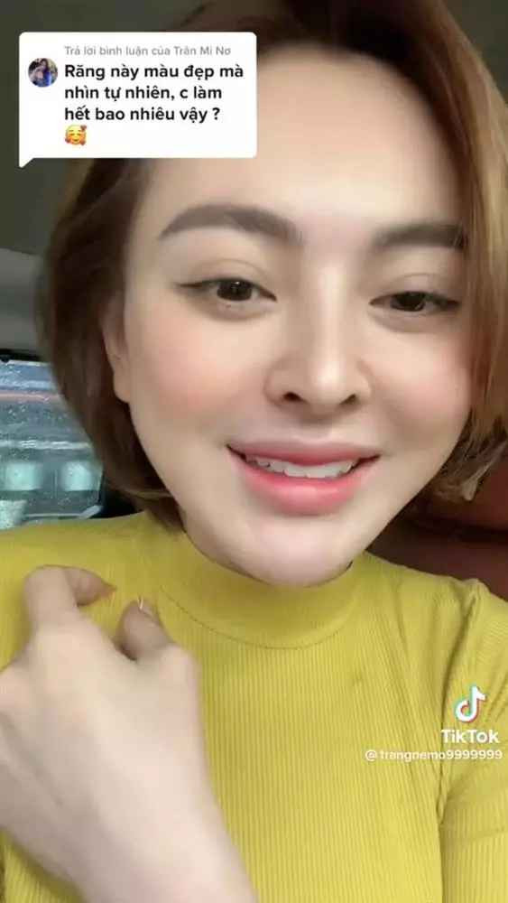 "Trang sửa lông mày 7 lần, phun mí mắt 2 lần, mở gốc mắt 1 lần, sửa mũi 2 lần, thu cánh mũi 1 lần, phun môi 3 lần, mở dáng môi 2 lần, gọt cằm 1 lần, nâng ngực 2 lần,... Nhiều quá mọi người ơi! Còn chỗ nào để em suy nghĩ thêm nha. Còn cái nết là sửa nhiều lần lắm rồi", cô từng tiết lộ.