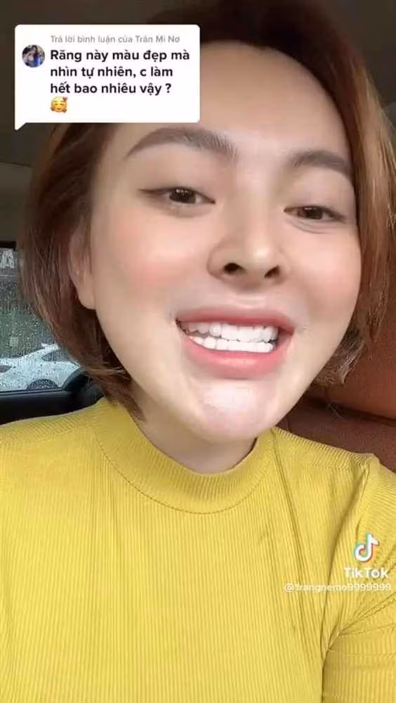 Trước đó, Trang Nemo cũng từng gây chú ý khi tiết lộ đã trải qua nhiều lần thẩm mỹ mới có được nhan sắc nổi bật. Vì sửa phần lớn khuôn mặt nên hiện tại, hot girl thị phi này vô cùng tự tin vào vẻ ngoài của bản thân.