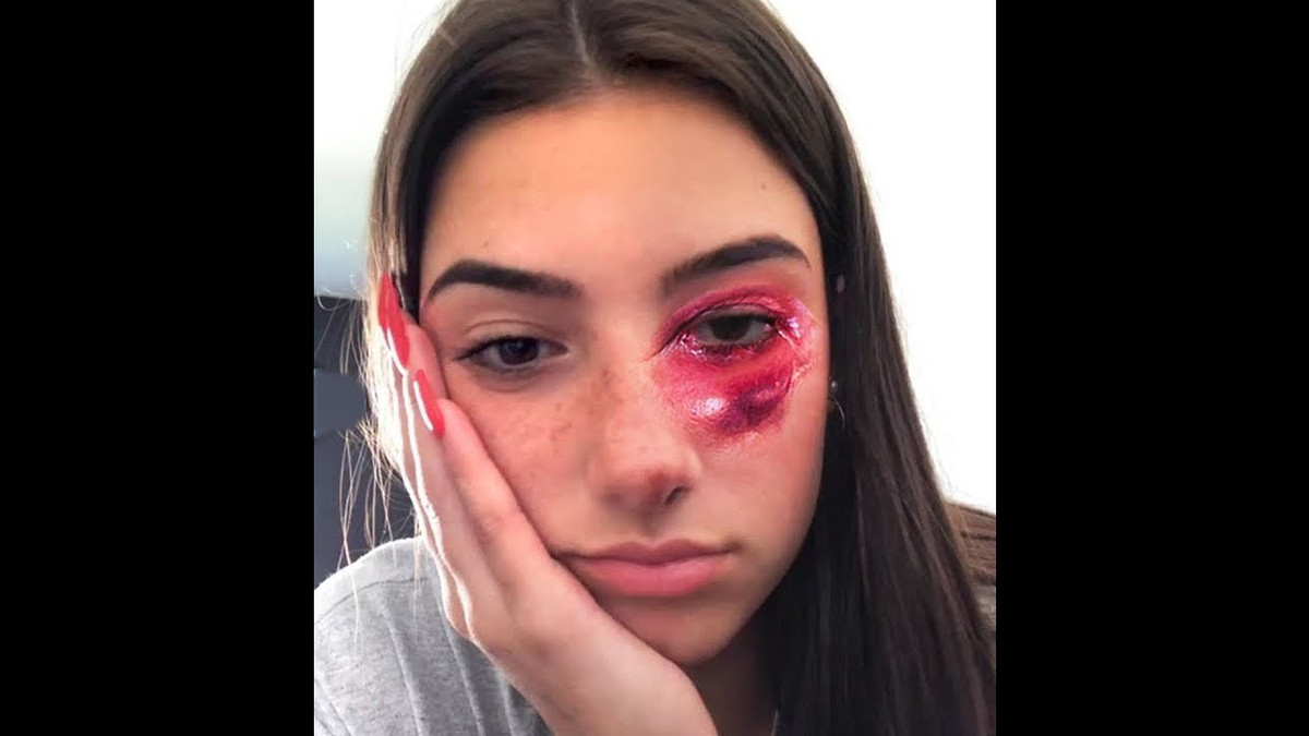 Đầu năm 2020, D'Amelio ký hợp đồng với một công ty quản lý người nổi tiếng tại Hollywood có tên UTA. Để thoát cái bóng TikToker, cô nàng bắt đầu đăng tải nội dung ở 2 nền tảng khác, dần rời xa TikTok.