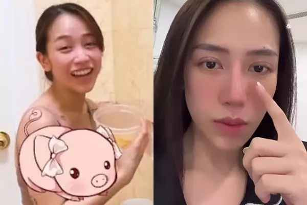 Trò chuyện cùng mọi người trên Instagram mới đây, Joyce Phạm cũng thoải mái tiết lộ về việc vừa mới làm mũi.