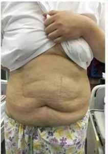 Với ước mơ sở hữu cơ thể thon gọn, Thuỷ Tiên quyết tâm thực hiện cuộc đại phẫu cắt mỡ thừa vùng bụng.