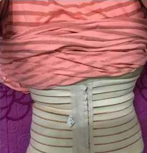 Tiếp sau đó, Thuỷ Tiên "dao kéo" hút mỡ bụng, bóc mỡ má.