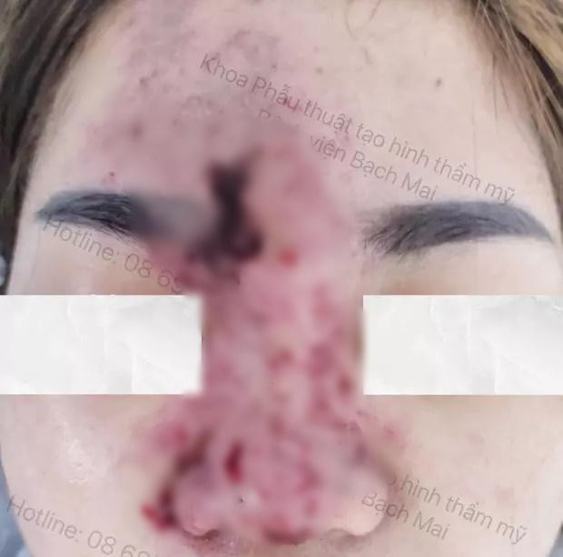 Nhìn cảnh tượng ai cũng bày tỏ hãi hùng. Chia buồn với cô gái "quay ô mất lượt", dân tình khuyên nhủ nhau "thà xấu tự nhiên còn hơn đẹp nhân tạo".