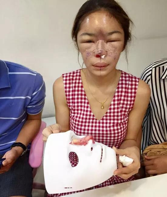 Phẫu thuật thẩm mỹ ngày nay không còn quá xa lạ. Với mong muốn cải thiện nhan sắc, nhiều người tìm đến các bệnh viện thẩm mỹ để trùng tu diện mạo.