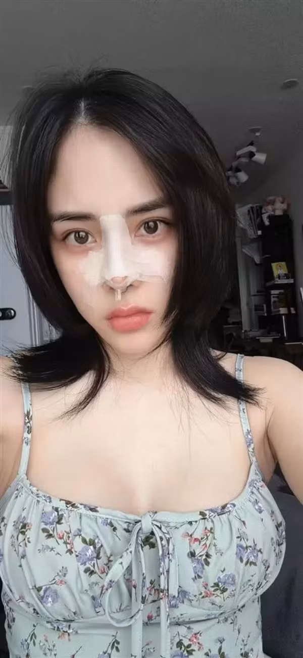 Có thể thấy, trải qua 3 lần thẩm mỹ, có lẽ Bạch Lan Phương vẫn chưa hài lòng về nhan sắc hiện tại của mình.