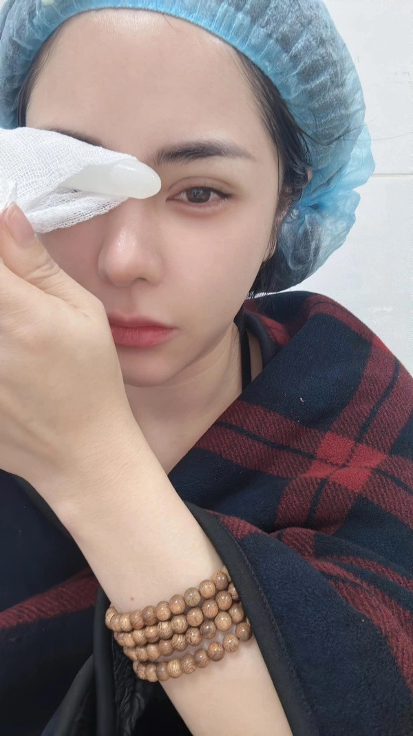 Được biết, Bạch Lan Phương đã trải qua 2 lần phẫu thuật sửa mũi. Để có được dáng mũi như hiện tại, nữ MC 8X khá "gian truân".