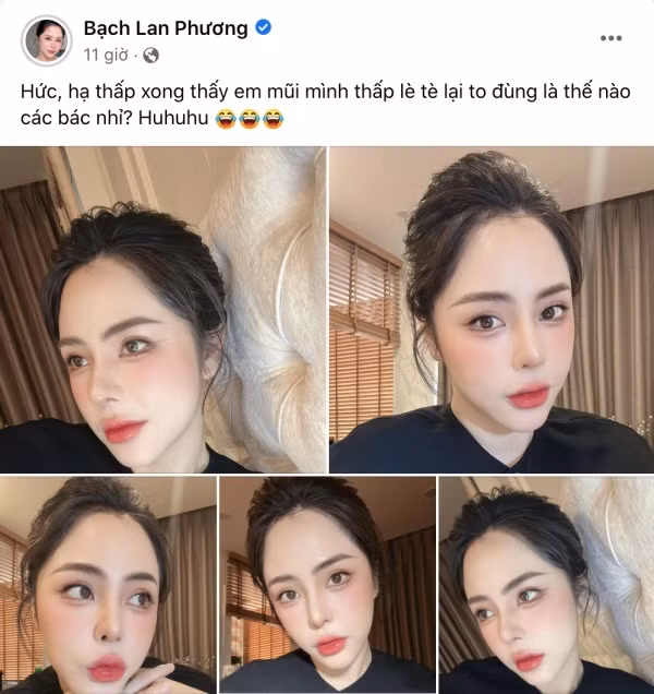 Mới đây nhất, bạn gái Huỳnh Anh là cô nàng Bạch Lan Phương vừa "than thở" trên trang cá nhân. Cô đăng tải loạt ảnh cận mặt kèm dòng chia sẻ: "Hức, hạ thấp xong thấy em mũi mình thấp lè tè lại to đùng là thế nào các bác nhỉ?".