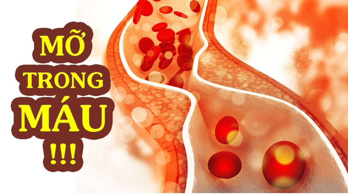 Mo trong mau cao anh huong rat xau den 'chuyen ay'