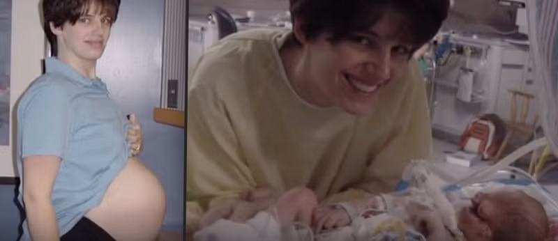 Suc song ky dieu cua be gai khong mat